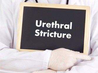 Urethral-Stricture